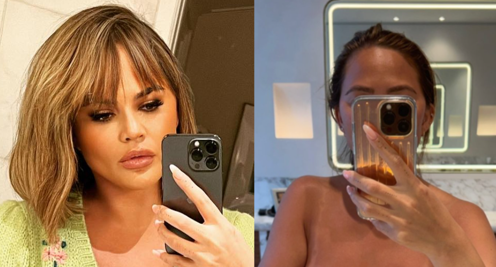 Chrissy Teigen