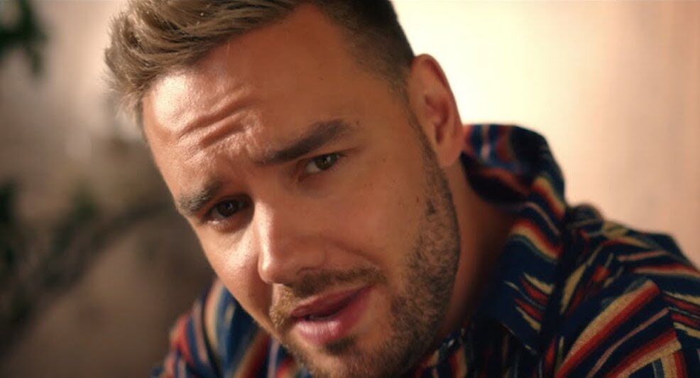 liam-payne-botox-one-direction