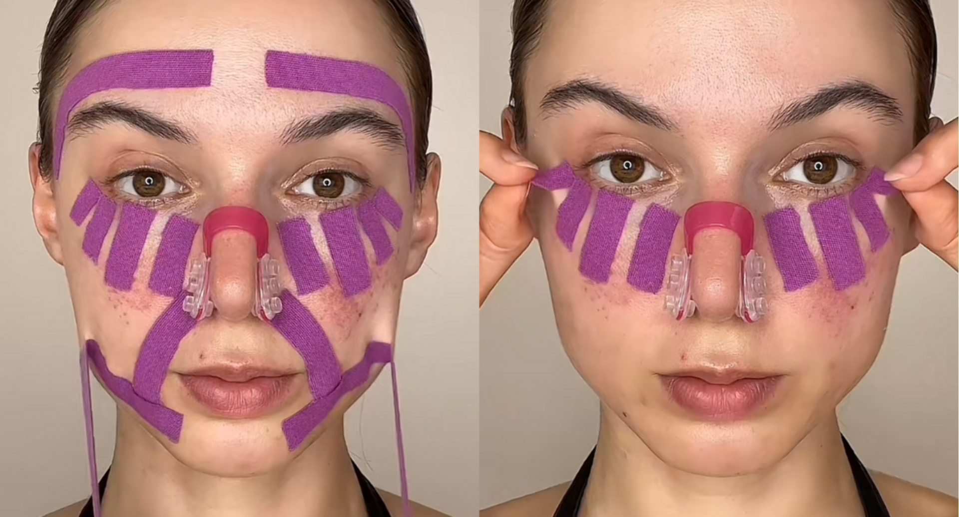 anti-rimpel-tape-hack