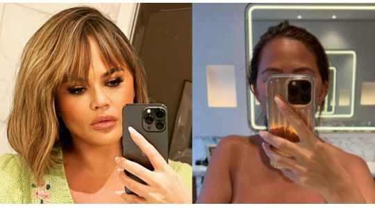 Chrissy Teigen